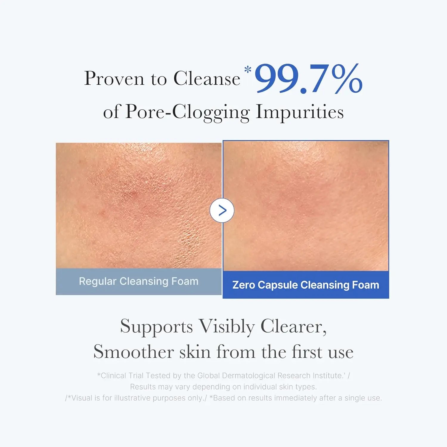 Medicube Zero Foam Cleanser for Sensitive Skin - Gentle Care