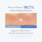 Medicube Zero Foam Cleanser for Sensitive Skin - Gentle Care